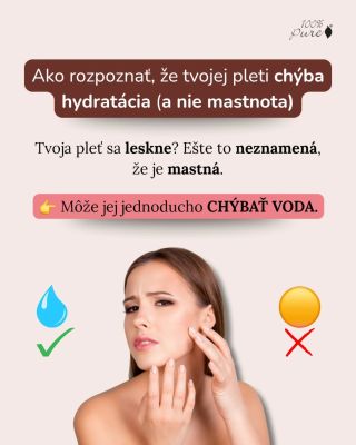 Tvoja pleť sa leskne? 💧 Možno nie je mastná… možno je len smädná. 💦 ♥️ Nauč sa, ako jej dopriať to, čo naozaj potrebuje....